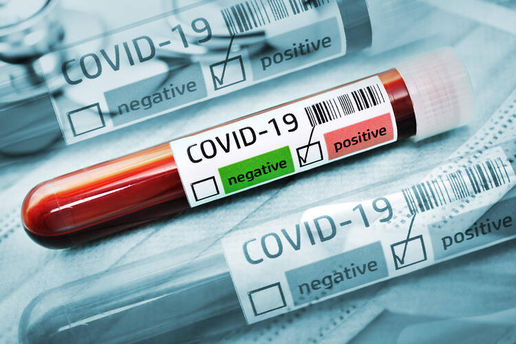 Korona Virüs Nedir? Nasıl Yayılır? Görsel